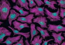 Quelle est la différence entre une tumeur et un cancer ?