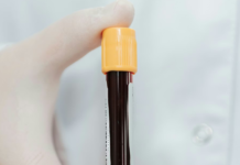 Une simple prise de sang pour traquer le cancer